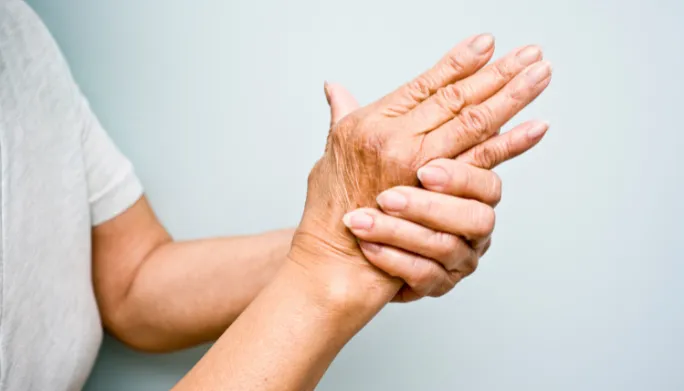 Arthritis